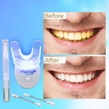 Smart LED Teeth Whitening Kit (DTW1)