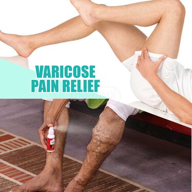 Varicose Pain Relief Spray B1G1 (PRS74)